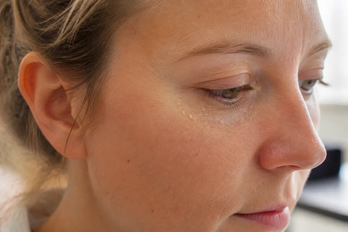 Boule de graisse visage : Comment les éliminer efficacement ?