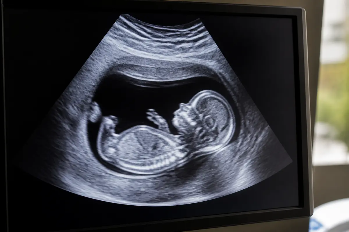 Échographie 12 semaines : Fille ou garçon, comment savoir ?