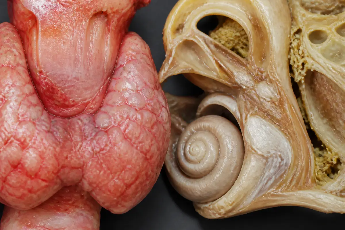 Thyroïde et oreille interne : Quel lien avec acouphènes et vertiges ?
